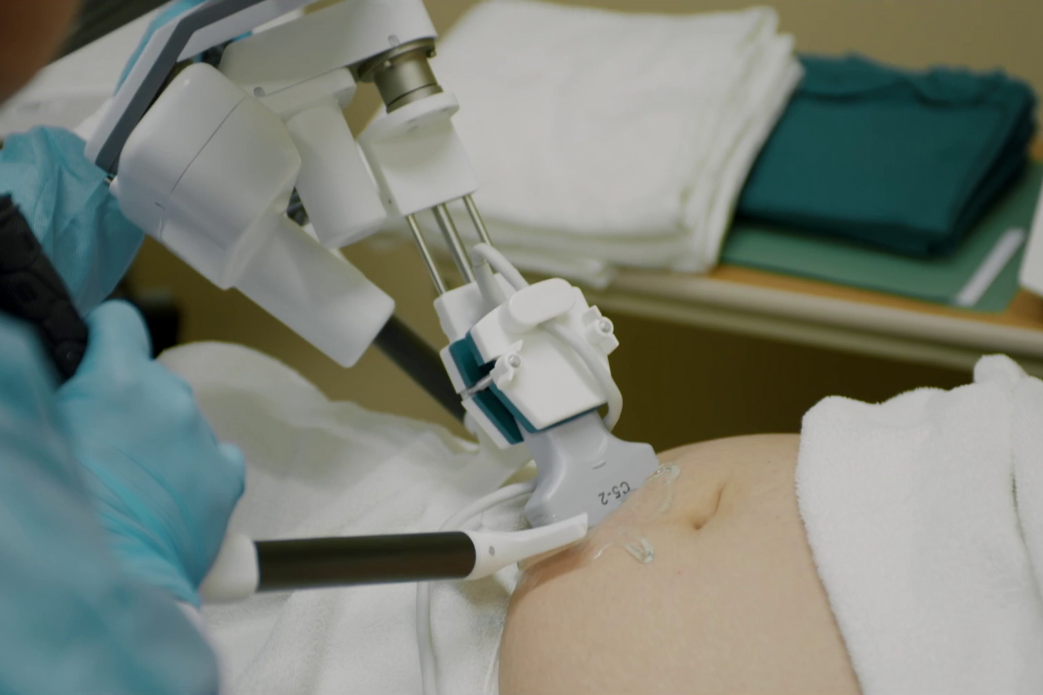 A robotic ultrasound machine scans a pregnant woman's stomach